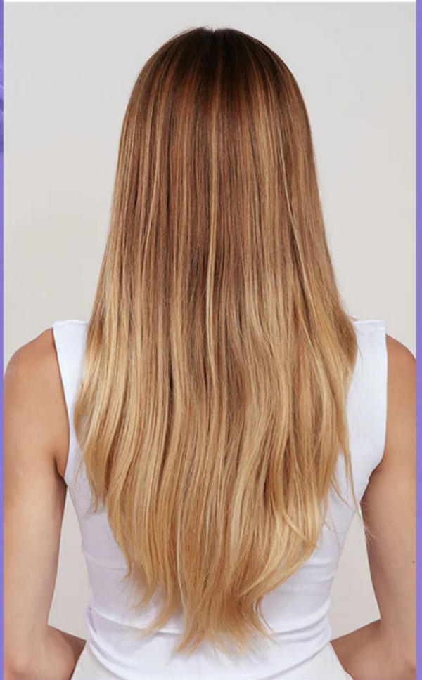 Before photo - Emily S